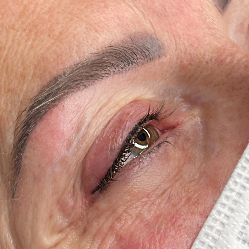 Correzione Sopracciglia